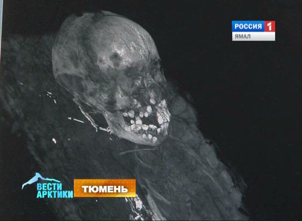 Томография мумии мальчика, найденного на Ямале
