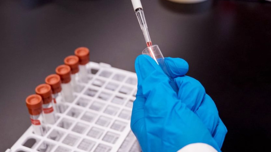 Ямал занимает третье место по заболеваемости вирусным гепатитом