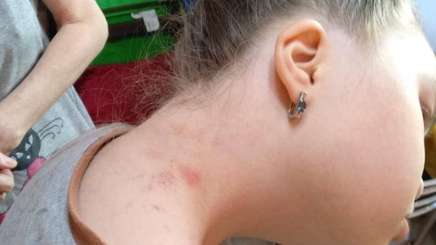 Схватили за шею: стали известны подробности жестокого обращения с ребенком-инвалидом на Ямале