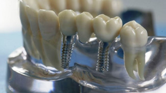 Участники боевых действий получат льготы на стоматологические операции