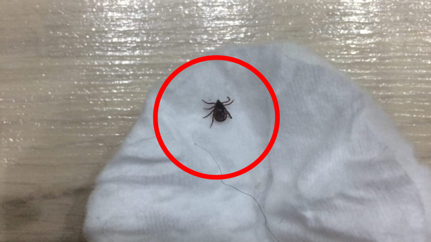 Клещи уже проснулись: в Ноябрьске обнаружили опасное насекомое
