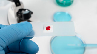 Жителей одного из сел на Ямале призывают сдать тесты на ВИЧ