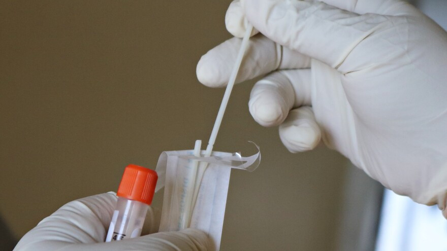 В ЯНАО коронавирус унес еще 2 жизни, 125 человек заболели  
