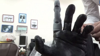 Тюменский студент разработал первый в России бионический протез пальца руки