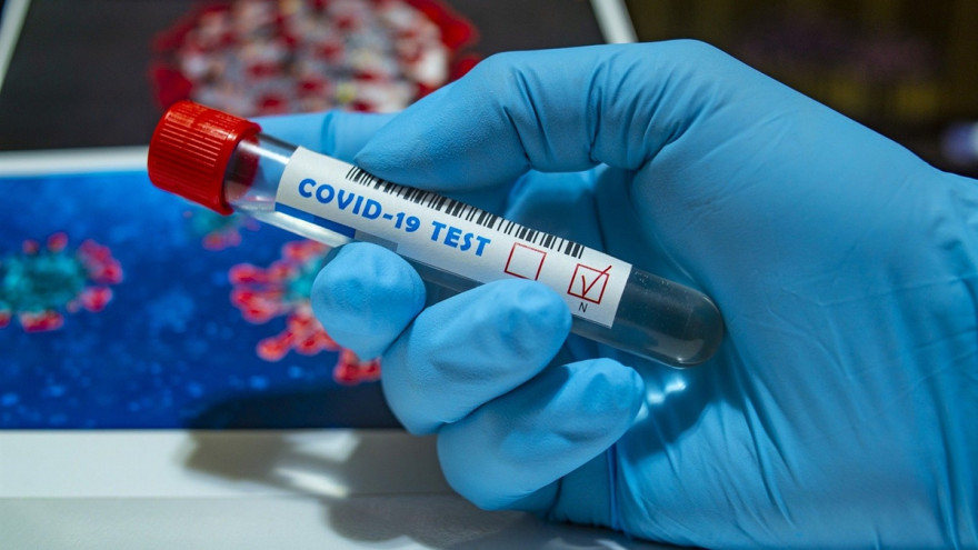 Ямал подошёл к отметке в миллион тестирований на коронавирусную инфекцию