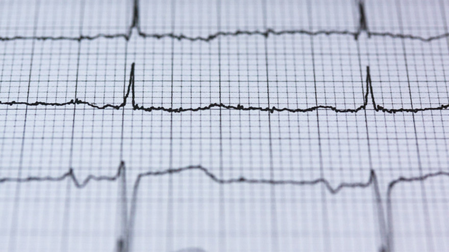 Острый инфаркт: медики Надымской скорой помощи спасли мужчине жизнь