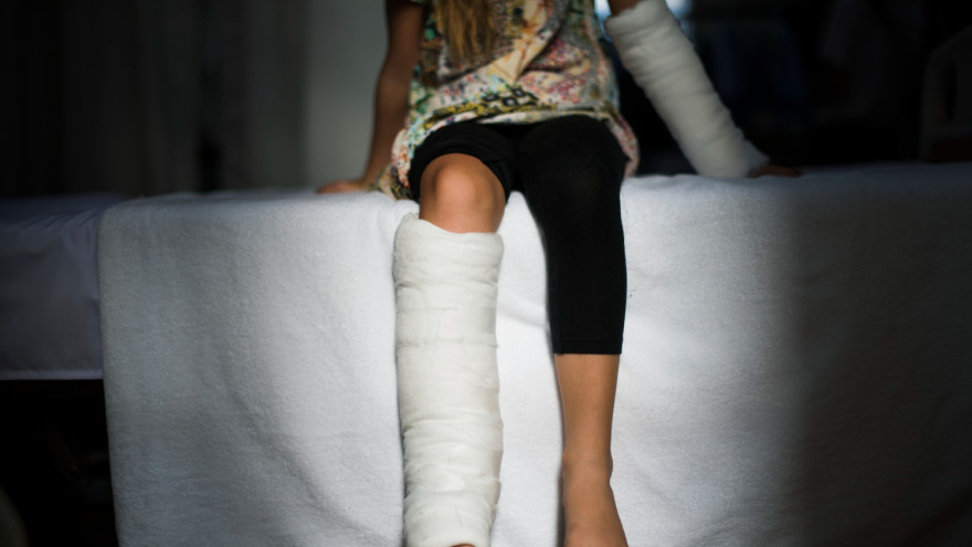 Ребенка госпитализировали: на Ямале 13-летняя мотоциклистка врезалась в столб