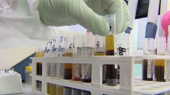 «Тихий убийца»: как распознать и обуздать диабет