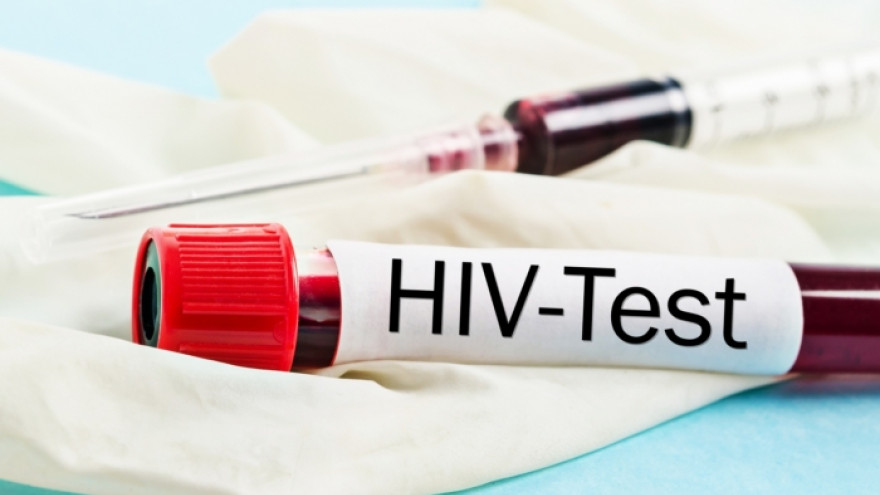 В Ноябрьске открылся первый на Ямале кабинет для экспресс-тестирования на ВИЧ