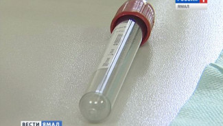 Специалисты назвали причины распространения ВИЧ-инфекции на Ямале