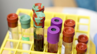Ученые назвали самую защищенную от коронавируса группу крови