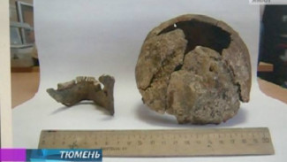 В Тюменской области нашли останки древнего ребенка со следами сложнейшей операции!