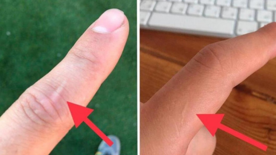 Откуда практически у всех мужчин шрам на левом указательном пальце?