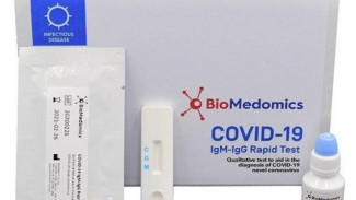 В ближайшие дни в производство поступят тесты, которые определят переболевших COVID-19 
