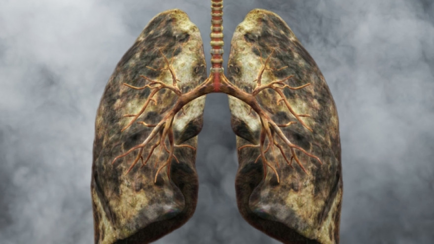 Ученые определили продукты, которые способствуют восстановлению легких курильщиков