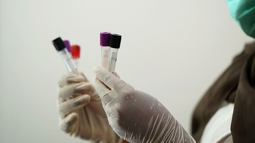6 апреля на Ямале зафиксировано 20 новых случаев коронавируса 