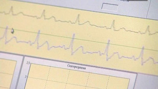 Инфаркты и инсульты: о статистике,  причинах и профилактике