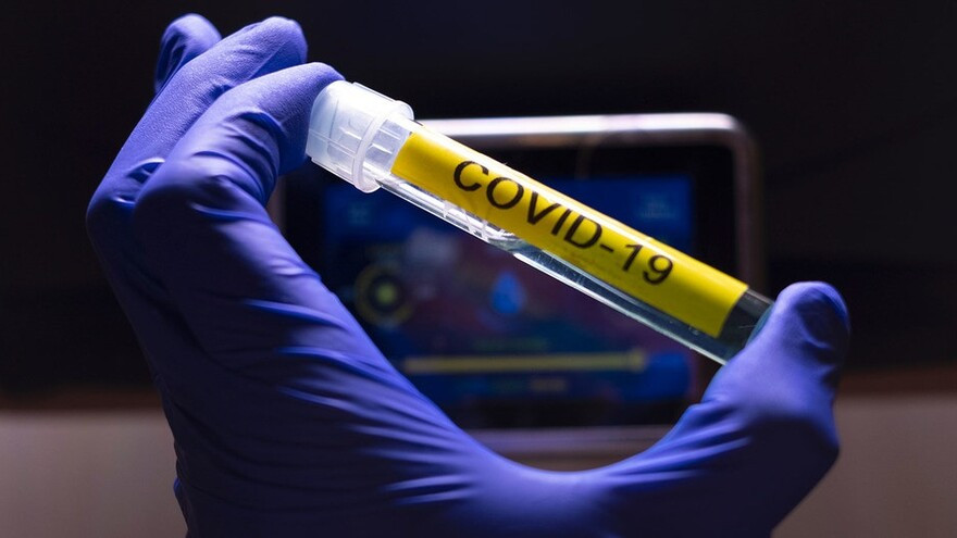 Актуальная информация по коронавирусу на Ямале: 2 летальных исхода и 186 заражённых