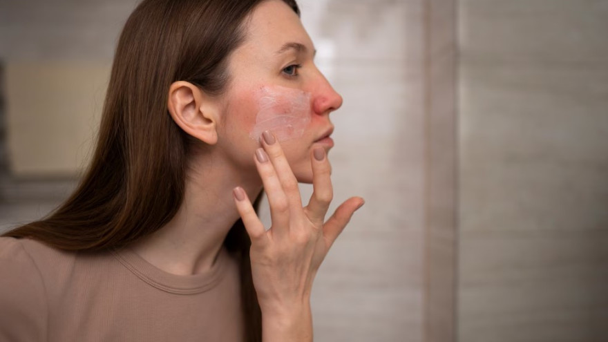 Обезвоживание кожи зимой: как предотвратить красноту, шелушение и зуд 