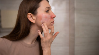 Обезвоживание кожи зимой: как предотвратить красноту, шелушение и зуд 
