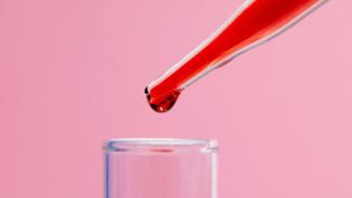 Благодаря липидному скринингу на Ямале выявили пациентов из группы риска