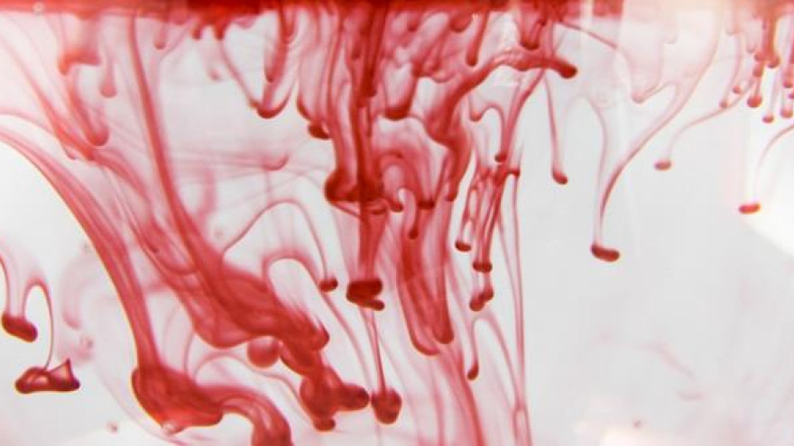 Пять простых продуктов, которые разжижают кровь и снижают риск тромбоза