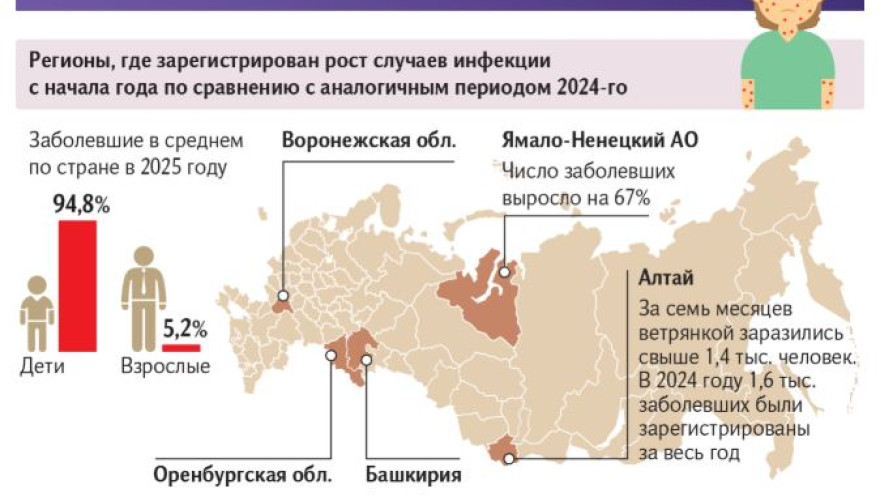 На Ямале зафиксирован рост заболевания ветрянкой