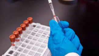 Ямал занимает третье место по заболеваемости вирусным гепатитом