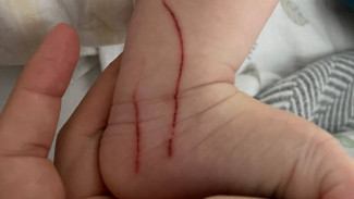Новорожденный поранился бракованной застежкой боди из набора «Малышу Ямала»