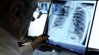 Рост заболеваемости туберкулезом не помешал оптимизировать расходы