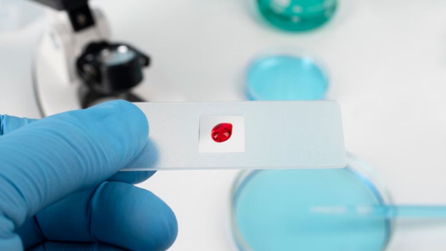 Жителей одного из сел на Ямале призывают сдать тесты на ВИЧ