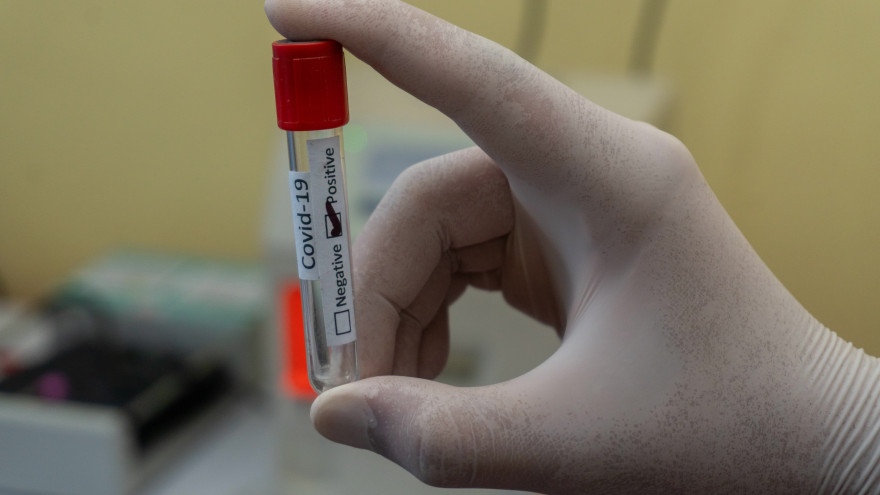 В ЯНАО выявили еще 129 новых случаев коронавируса