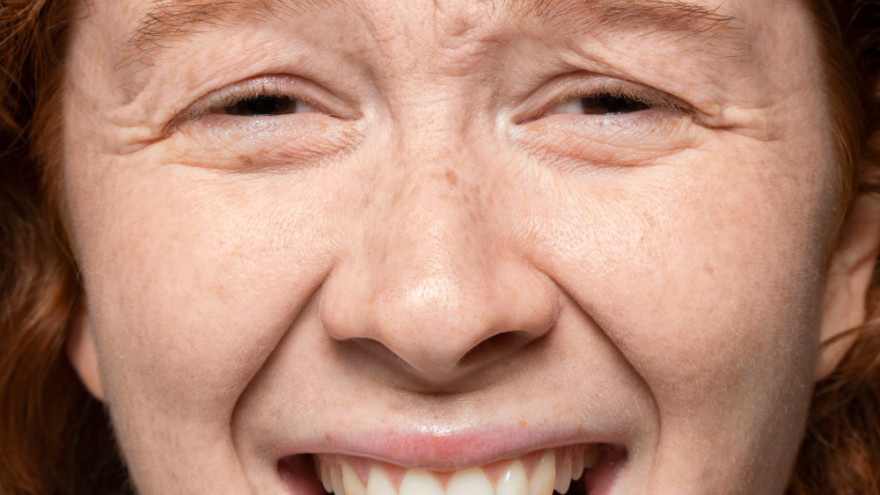 Почему кожа быстро стареет: 10 ошибок, которые убивают молодость